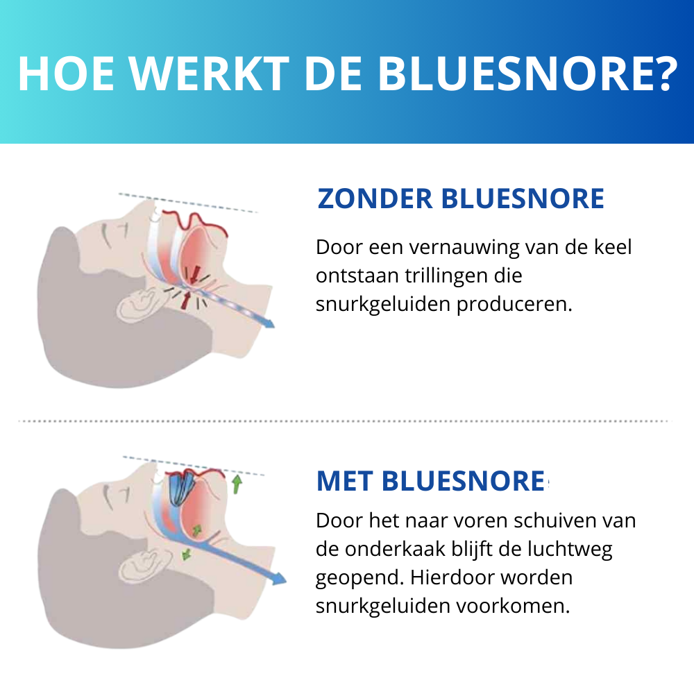 Snoozeguard - Anti snurk bitje