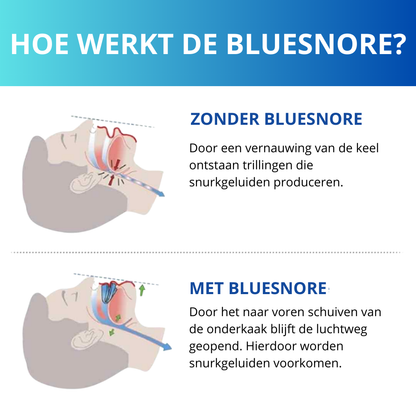 Snoozeguard - Anti snurk bitje